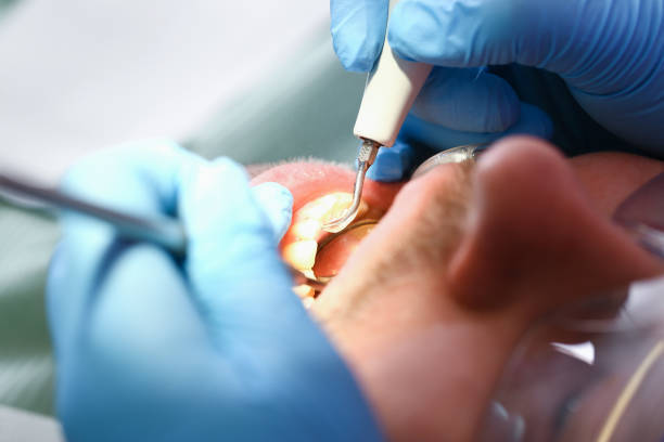 Best Emergency TMJ Treatment in Balfour, NC