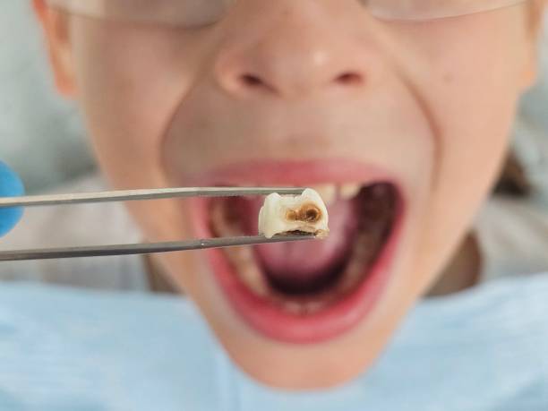 Best Cosmetic Emergency Dentistry in Balfour, NC