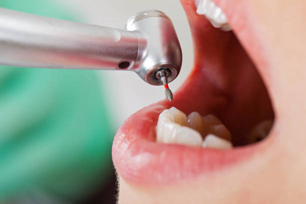 Best Emergency Denture Repair in Balfour, NC